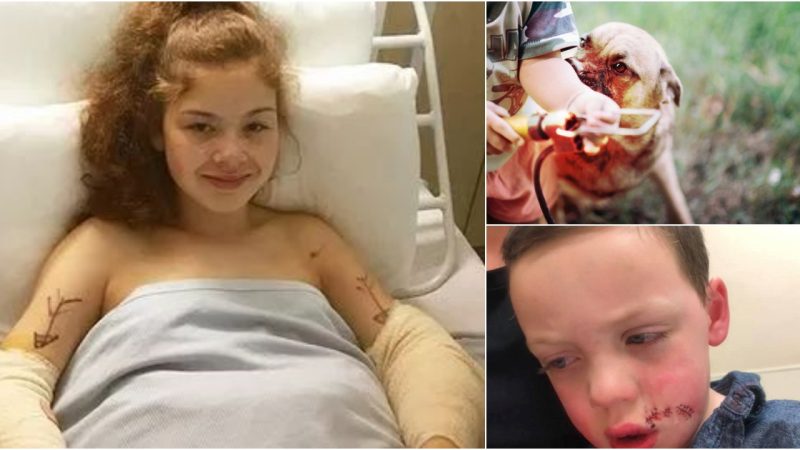 Brave Girl Saves Cousin From Violent Dog, Bitten 16 Times and Scarred for Life