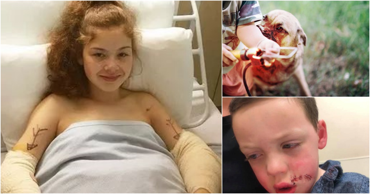 Brave Girl Saves Cousin From Violent Dog, Bitten 16 Times and Scarred for Life