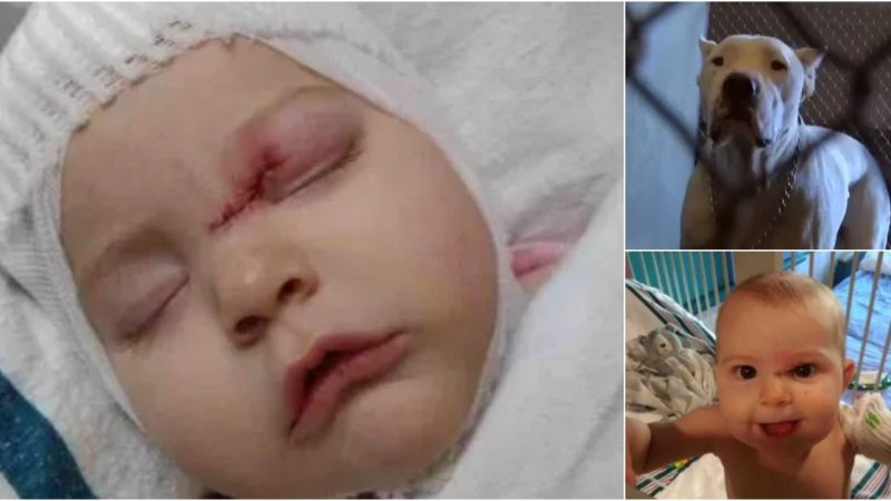 Tragedy Strikes: Six-Month-Old Girl Suffers Brain Injury in Dog Attack