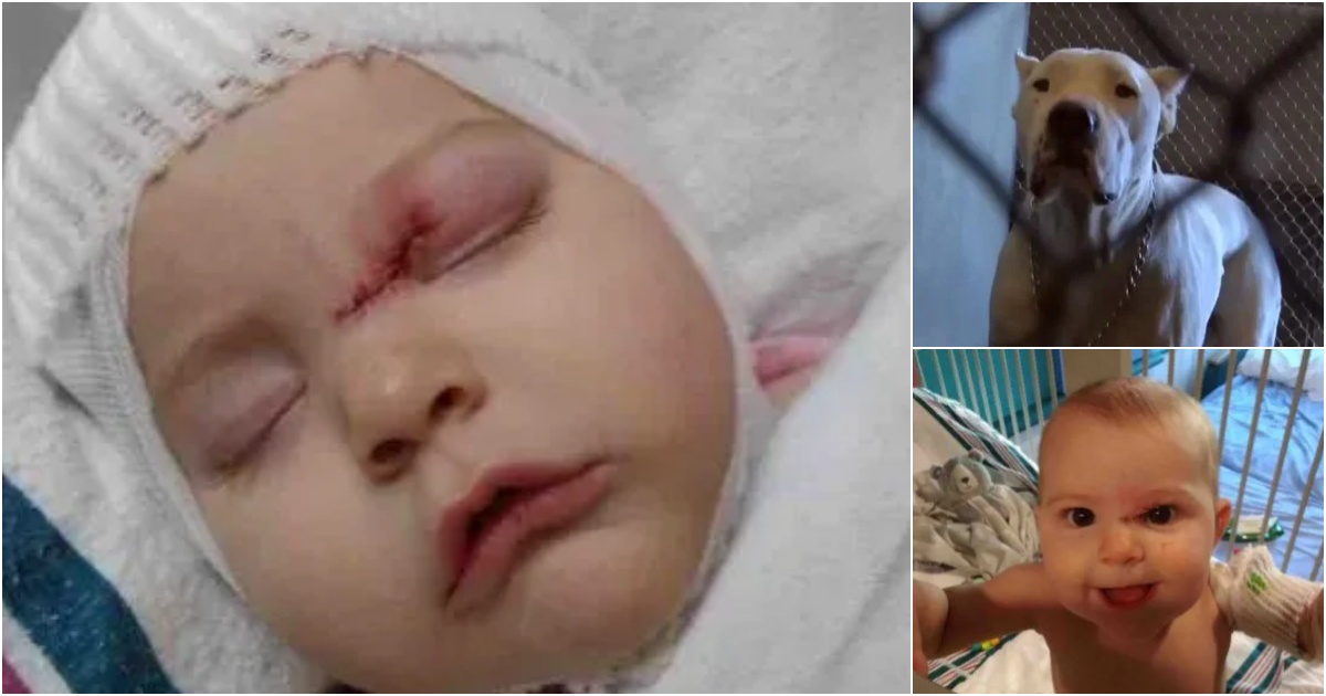 Tragedy Strikes: Six-Month-Old Girl Suffers Brain Injury in Dog Attack