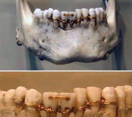 Ancient Egyptian Dental Mastery: 4,000-Year-Old Techniques That Still Amaze Today