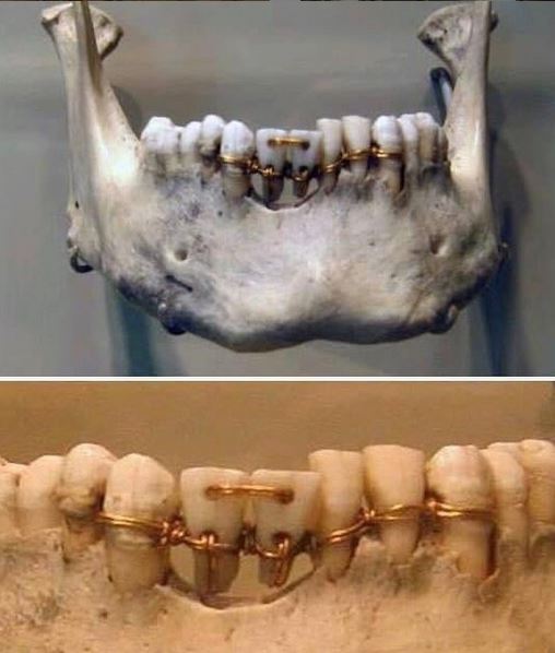 Ancient Egyptian Dental Mastery: 4,000-Year-Old Techniques That Still Amaze Today